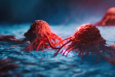 Nadir bir kanser türü gençler arasında yükselişte